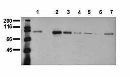 Western blot analysis of Catenin, beta antibody in A431 (1-40)(Lane1),A480 (1-42)(Lane2),SW620 (1-43)(Lane3),HT29 (Lane4),MCF7 (Lane5),MDA-MB231 (Lane6),T47D (Lane7) lysate