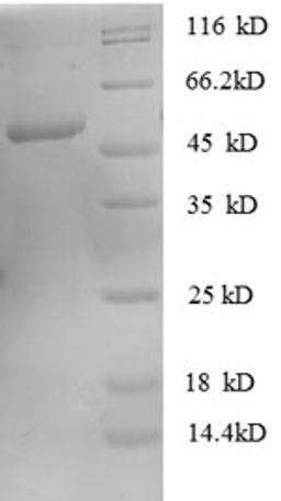 (Tris-Glycine gel) Discontinuous SDS-PAGE (reduced) with 5% enrichment gel and 15% separation gel.