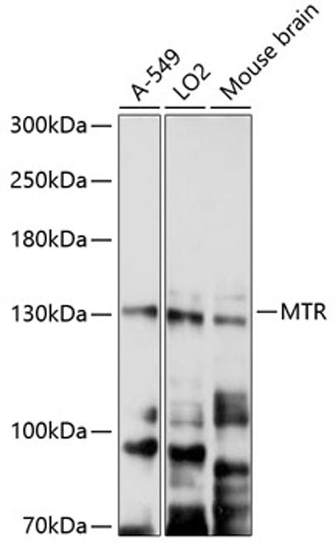 Western blot - MTR antibody (A9731)