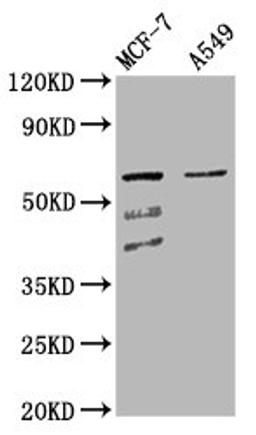 Western Blot. Positive WB detected in: MCF-7 whole cell lysate, A549 whole cell lysate. All lanes: SLC22A5 antibody at 4.3µg/ml. Secondary. Goat polyclonal to rabbit IgG at 1/50000 dilution. Predicted band size: 63, 25, 66 kDa. Observed band size: 63 kDa