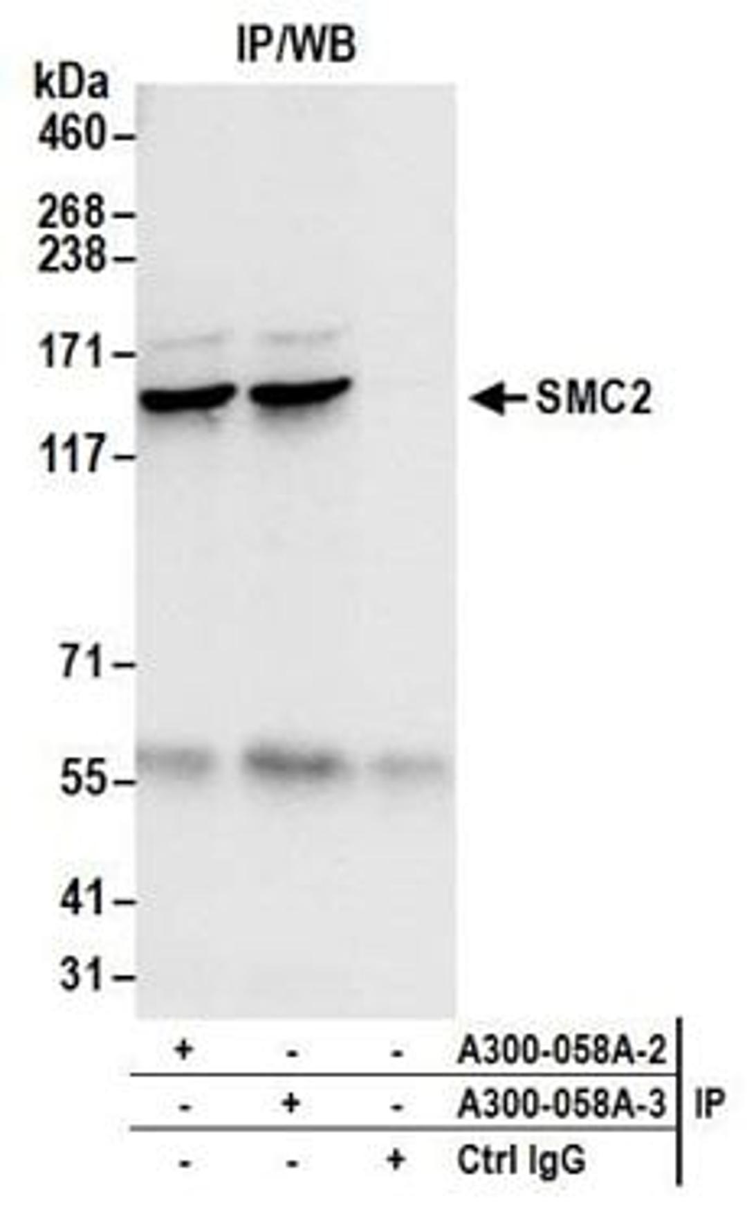 Detection of human SMC2 by western blot of immunoprecipitates.