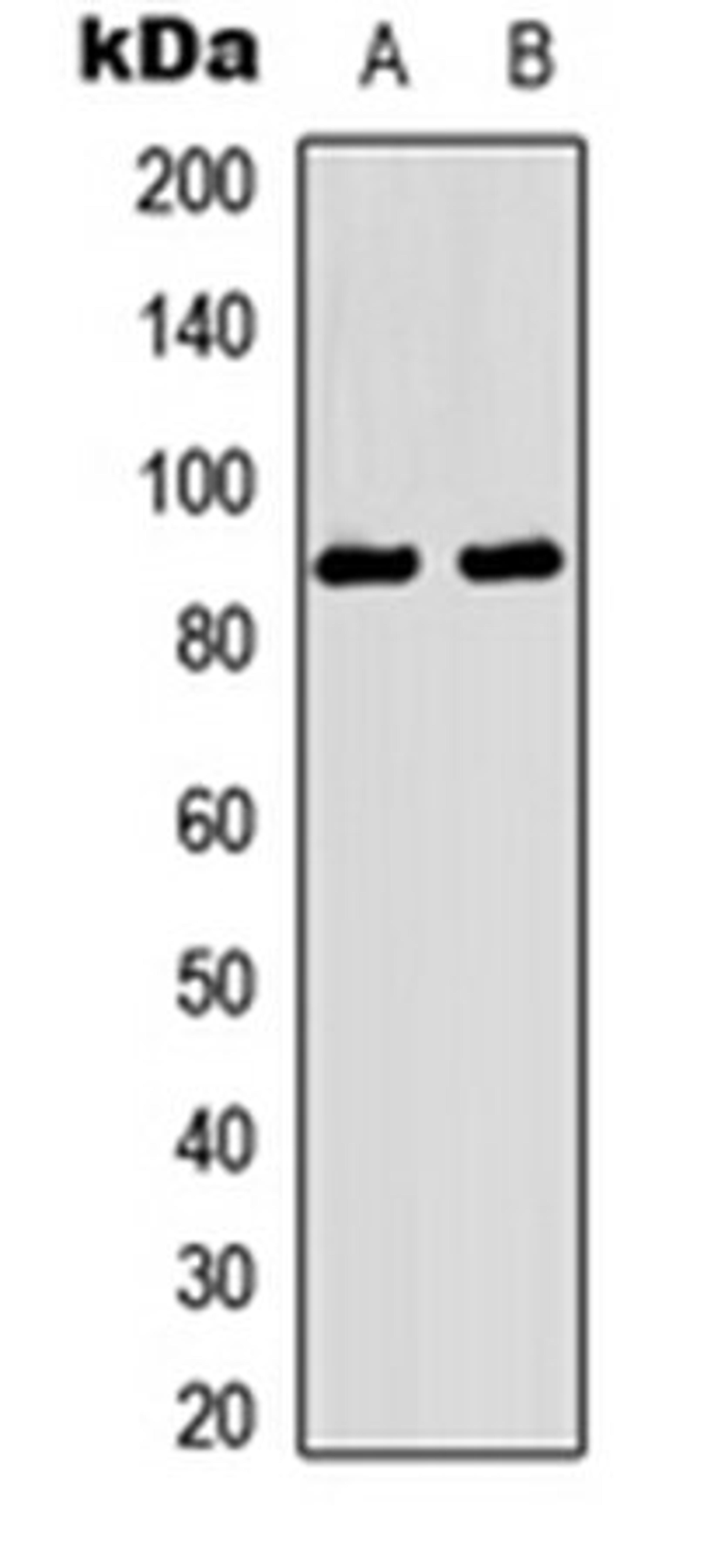 Western blot analysis of mouse brain (Lane 1), rat brain (Lane 2) whole cell lysates using TRK A (Phospho-Y496) antibody