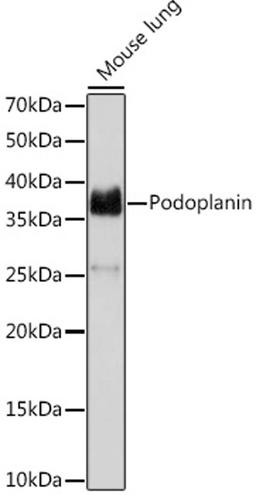 Western blot - Podoplanin Rabbit mAb (A9242)