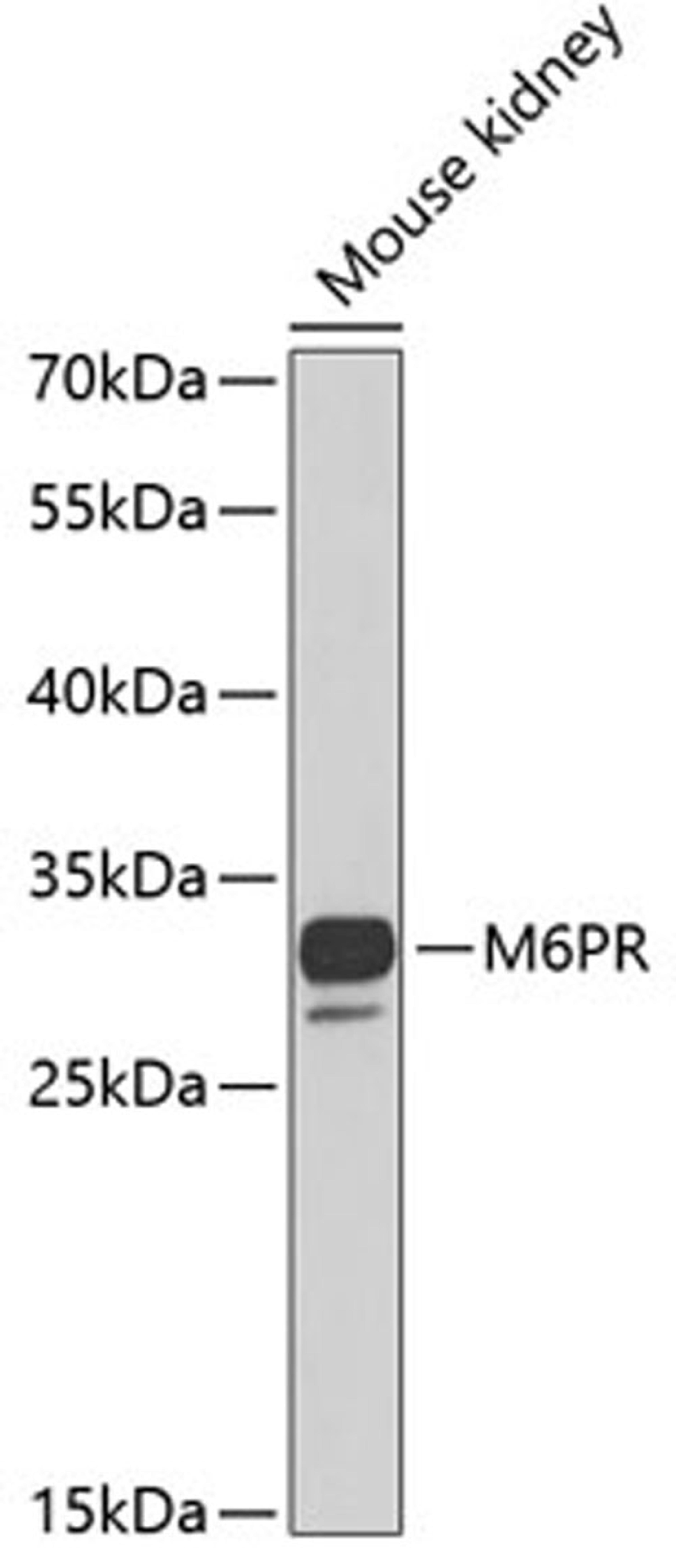 Western blot - M6PR antibody (A6296)