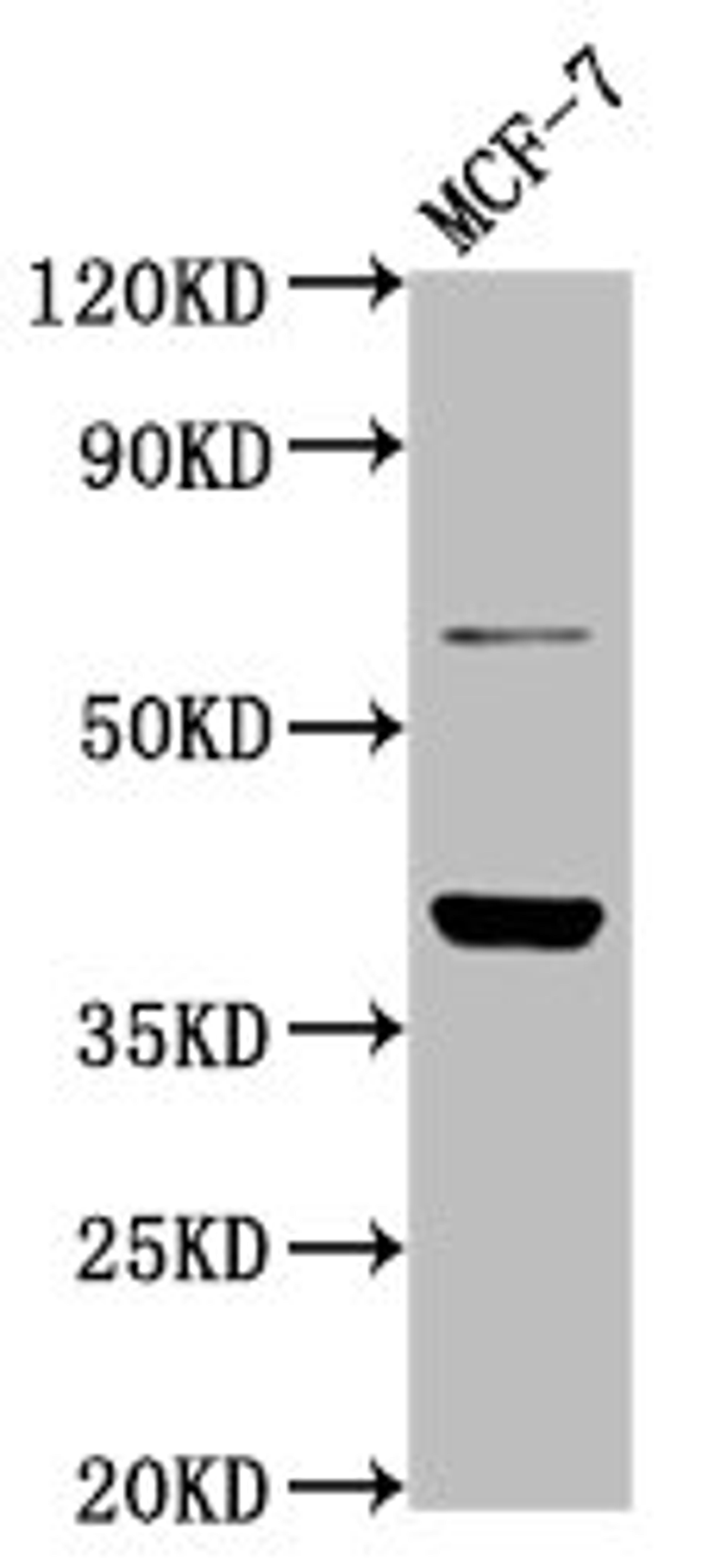 Western Blot. Positive WB detected in: MCF-7 whole cell lysate. All lanes: LAPTM4B antibody at 4.8ug/ml. Secondary. Goat polyclonal to rabbit IgG at 1/50000 dilution. Predicted band size: 42, 26, 36 kDa. Observed band size: 42 kDa.