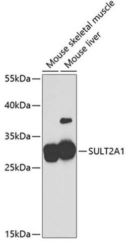 Western blot - SULT2A1 antibody (A5489)