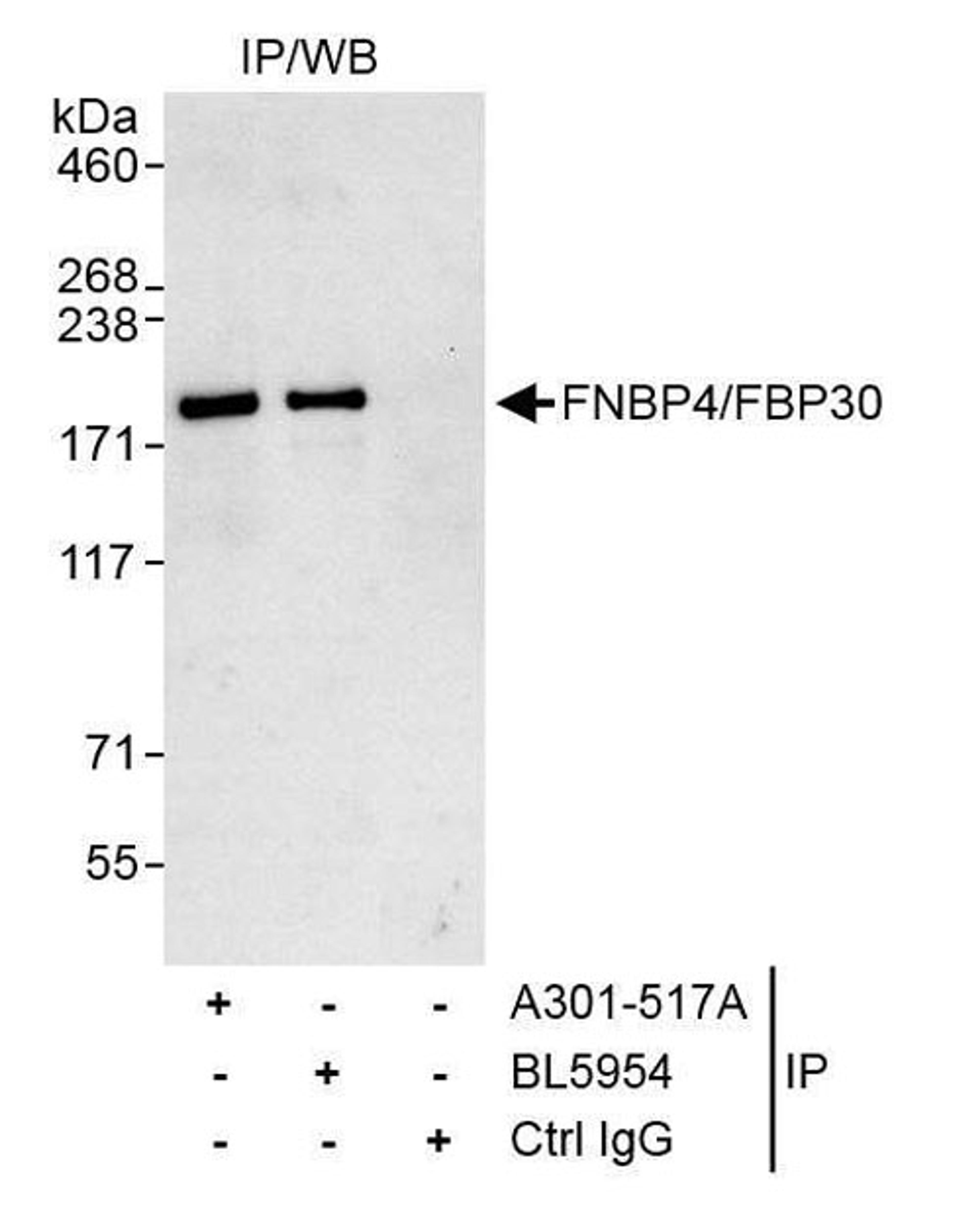 Detection of human FNBP4/FBP30 by WB of IP.