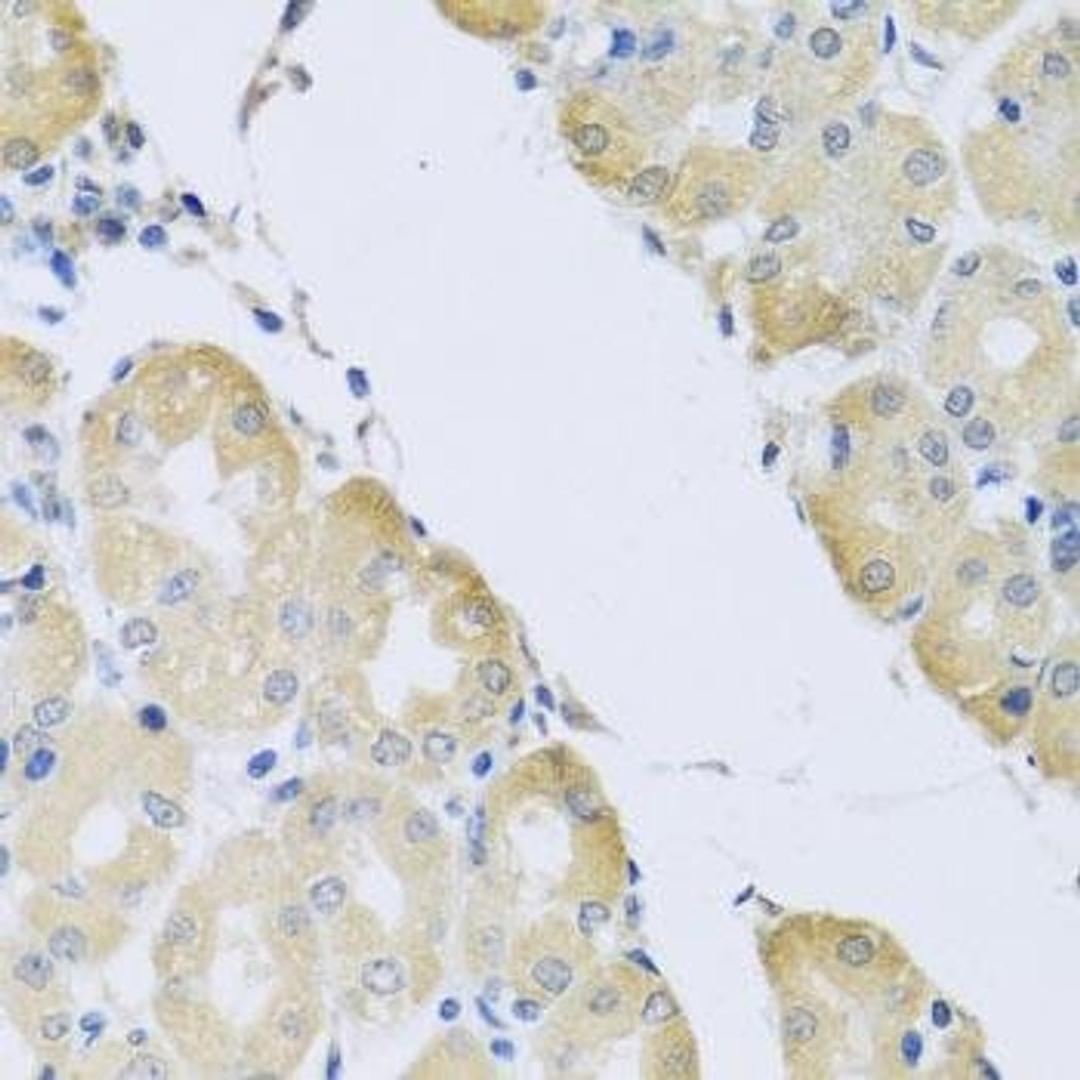 Immunohistochemical staining of mouse lung tissue using ATP2C1 antibody (dilution of 1:100)