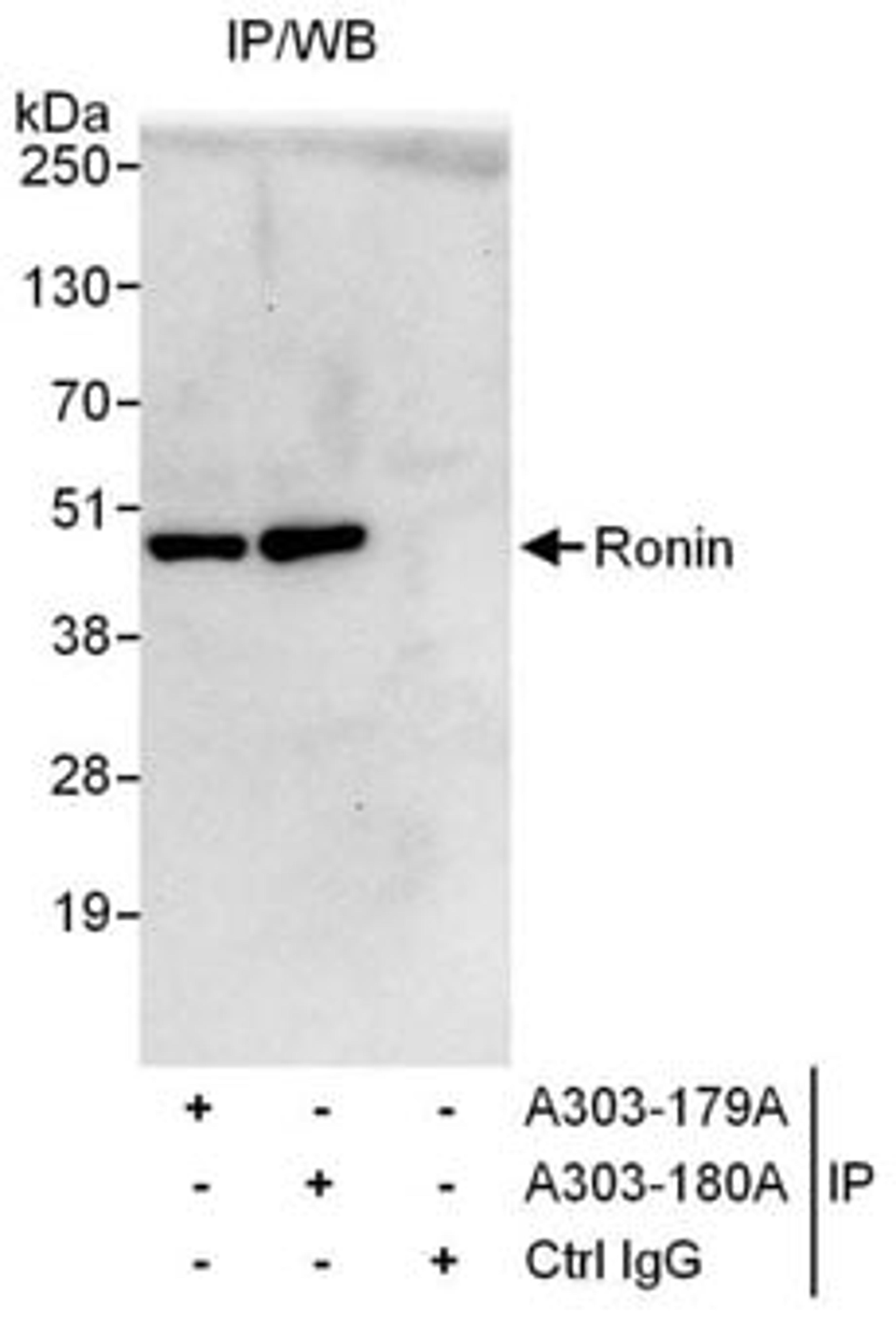 Detection of human Ronin by western blot of immunoprecipitates.