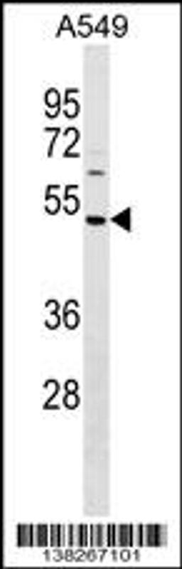 Western blot analysis in A549 cell line lysates (35ug/lane).