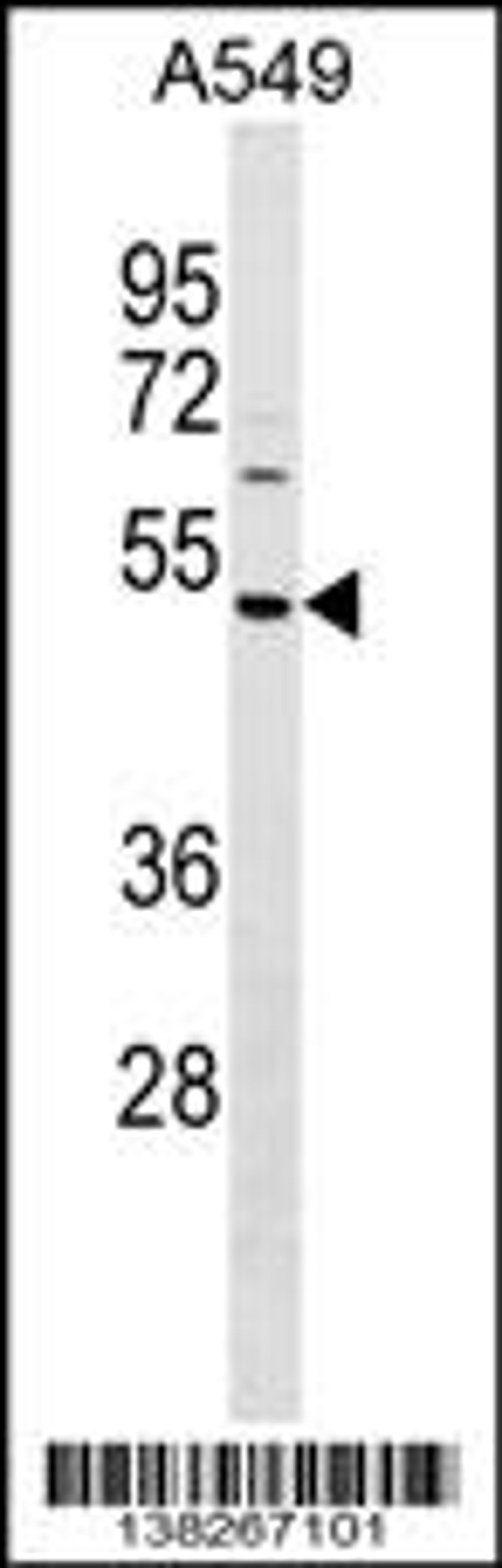 Western blot analysis in A549 cell line lysates (35ug/lane).