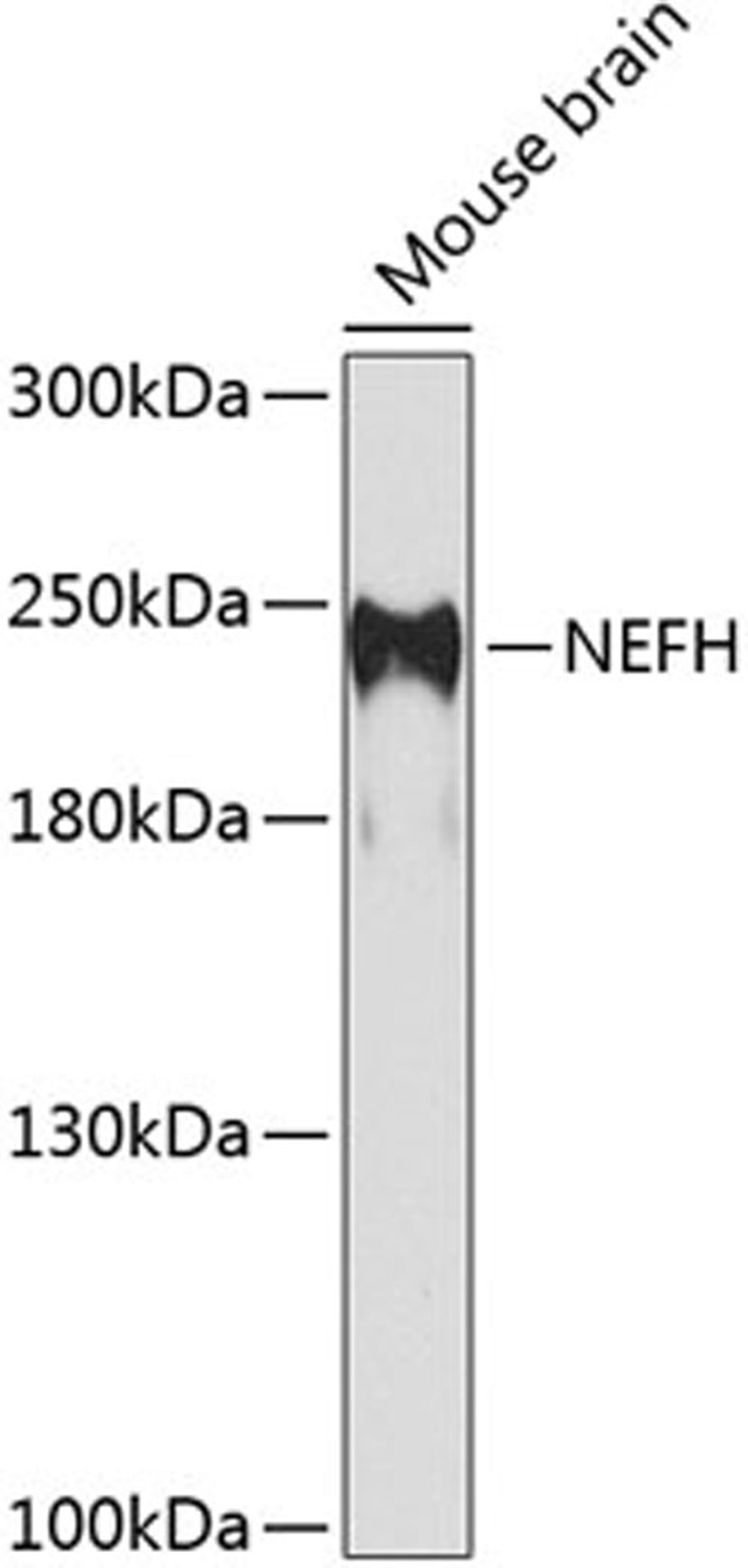 Western blot - NEFH antibody (A8442)