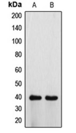 Western blot analysis of HeLa (Lane 1), H9C2 (Lane 2) whole cell lysates using ATP6V0D1 antibody