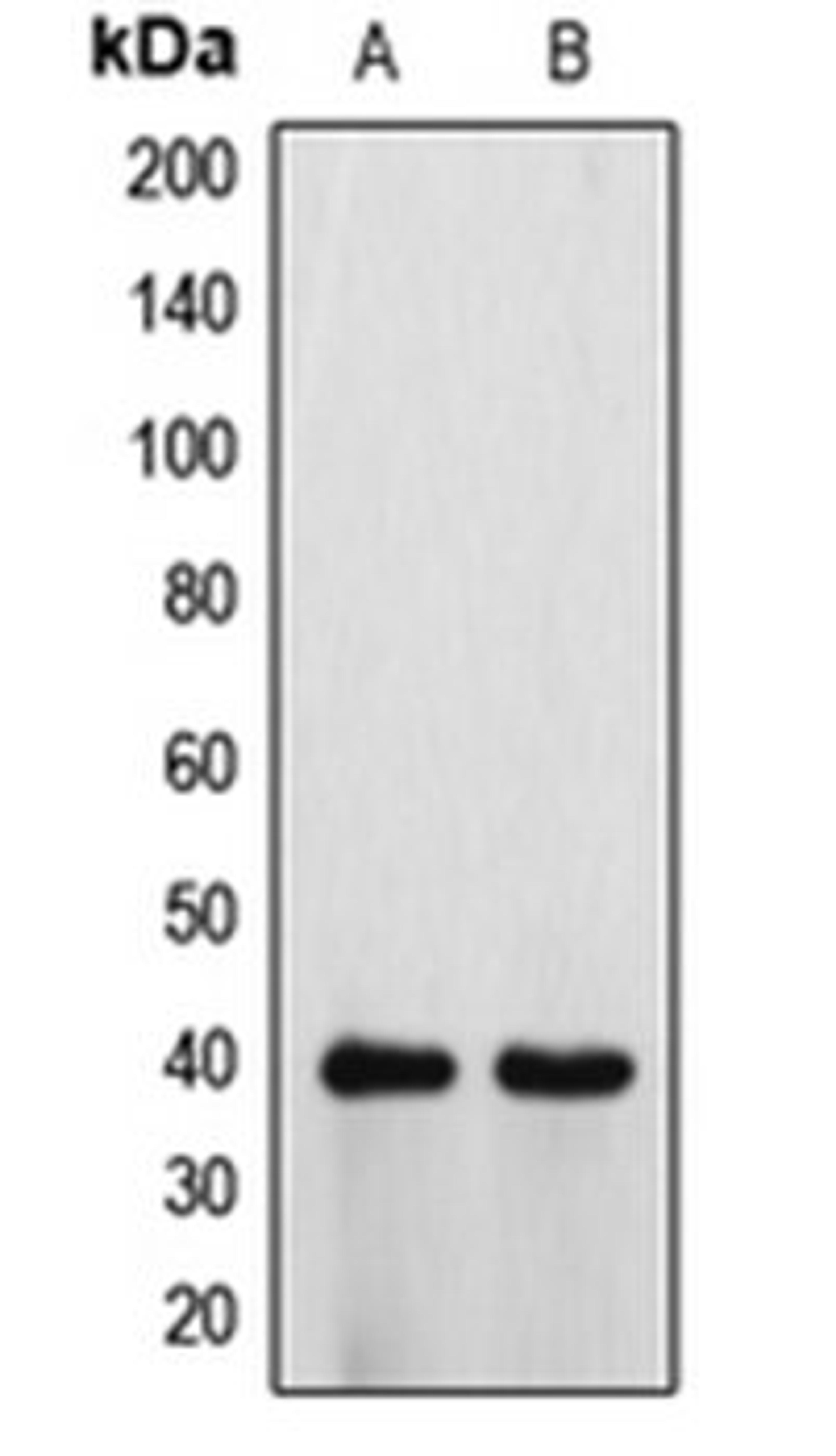 Western blot analysis of HeLa (Lane 1), H9C2 (Lane 2) whole cell lysates using ATP6V0D1 antibody