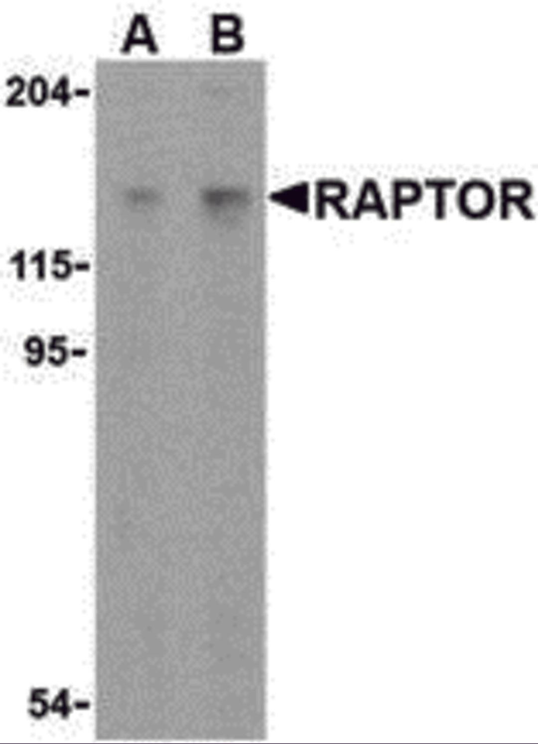 Western blot analysis of Raptor in L1210 cell lysate with Raptor antibody at (A) 2 and (B) 4 &#956;g/mL.