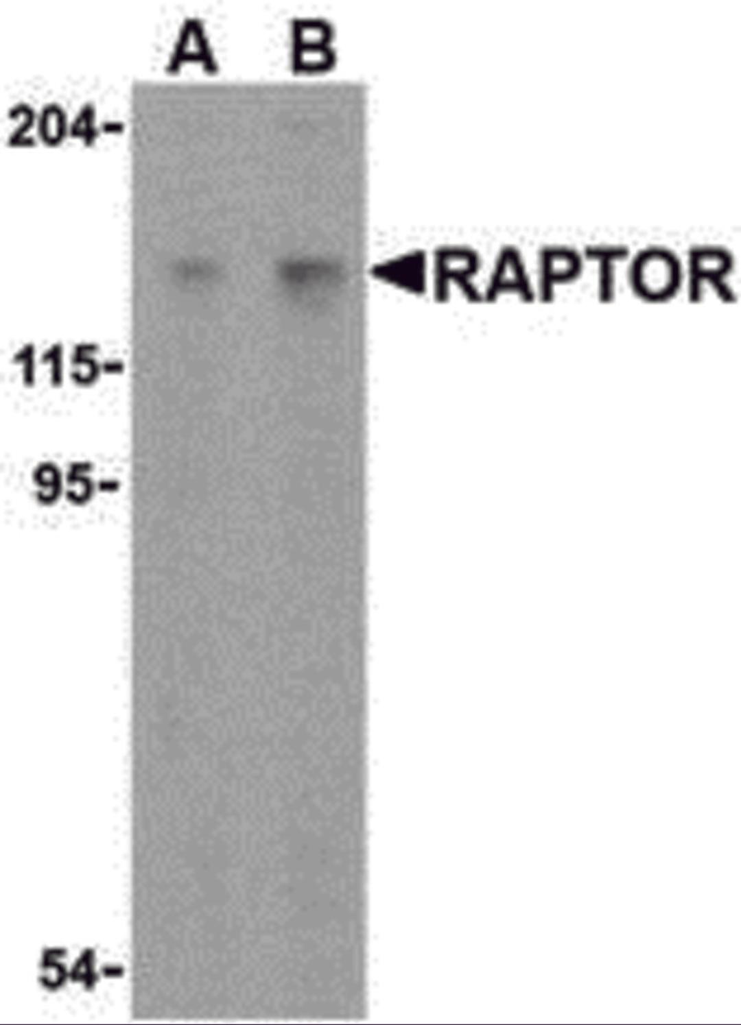 Western blot analysis of Raptor in L1210 cell lysate with Raptor antibody at (A) 2 and (B) 4 μg/mL.