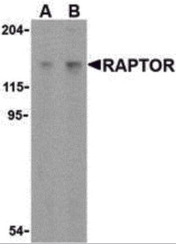 Western blot analysis of Raptor in L1210 cell lysate with Raptor antibody at (A) 2 and (B) 4 μg/mL.