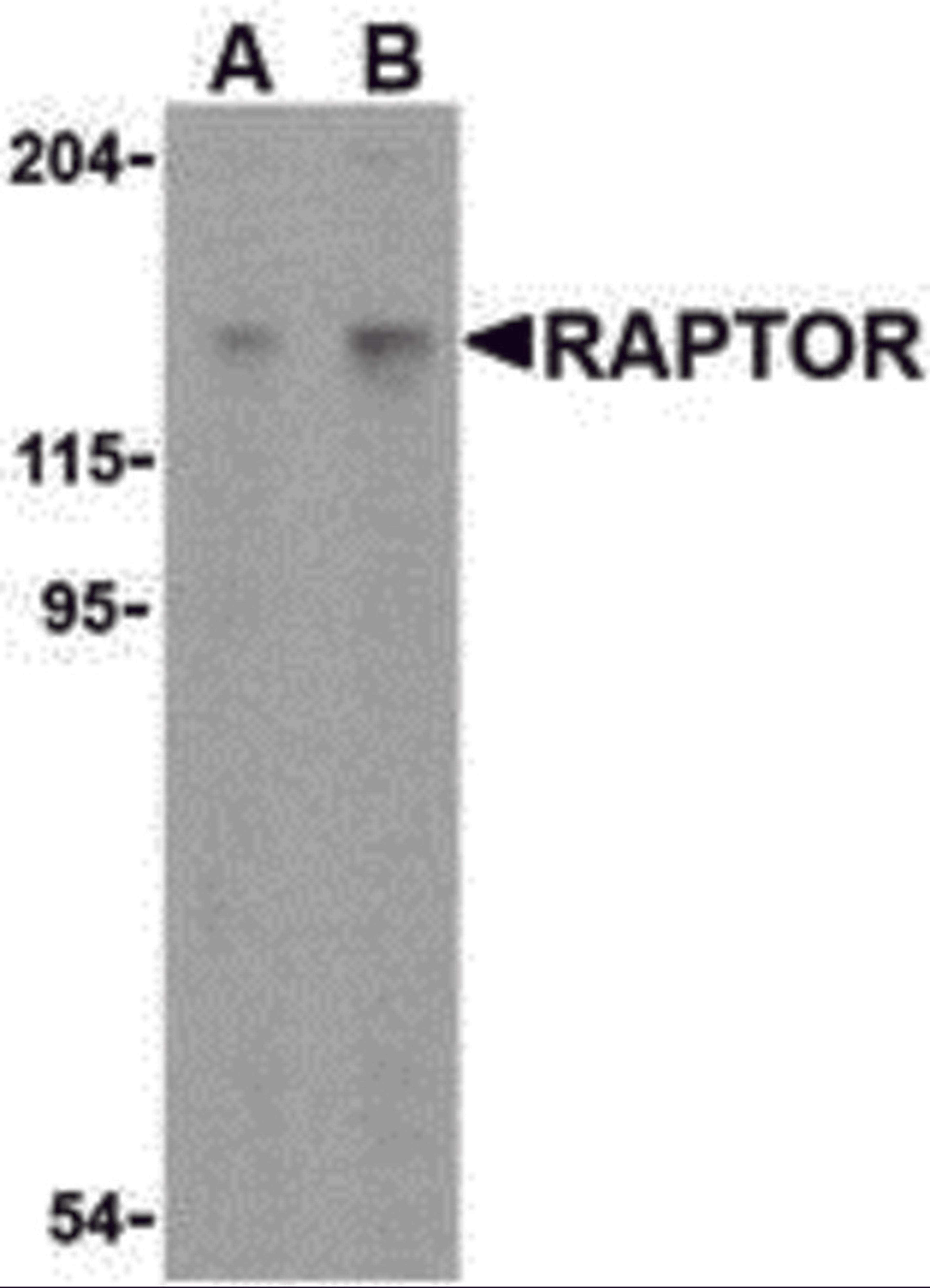 Western blot analysis of Raptor in L1210 cell lysate with Raptor antibody at (A) 2 and (B) 4 μg/mL.