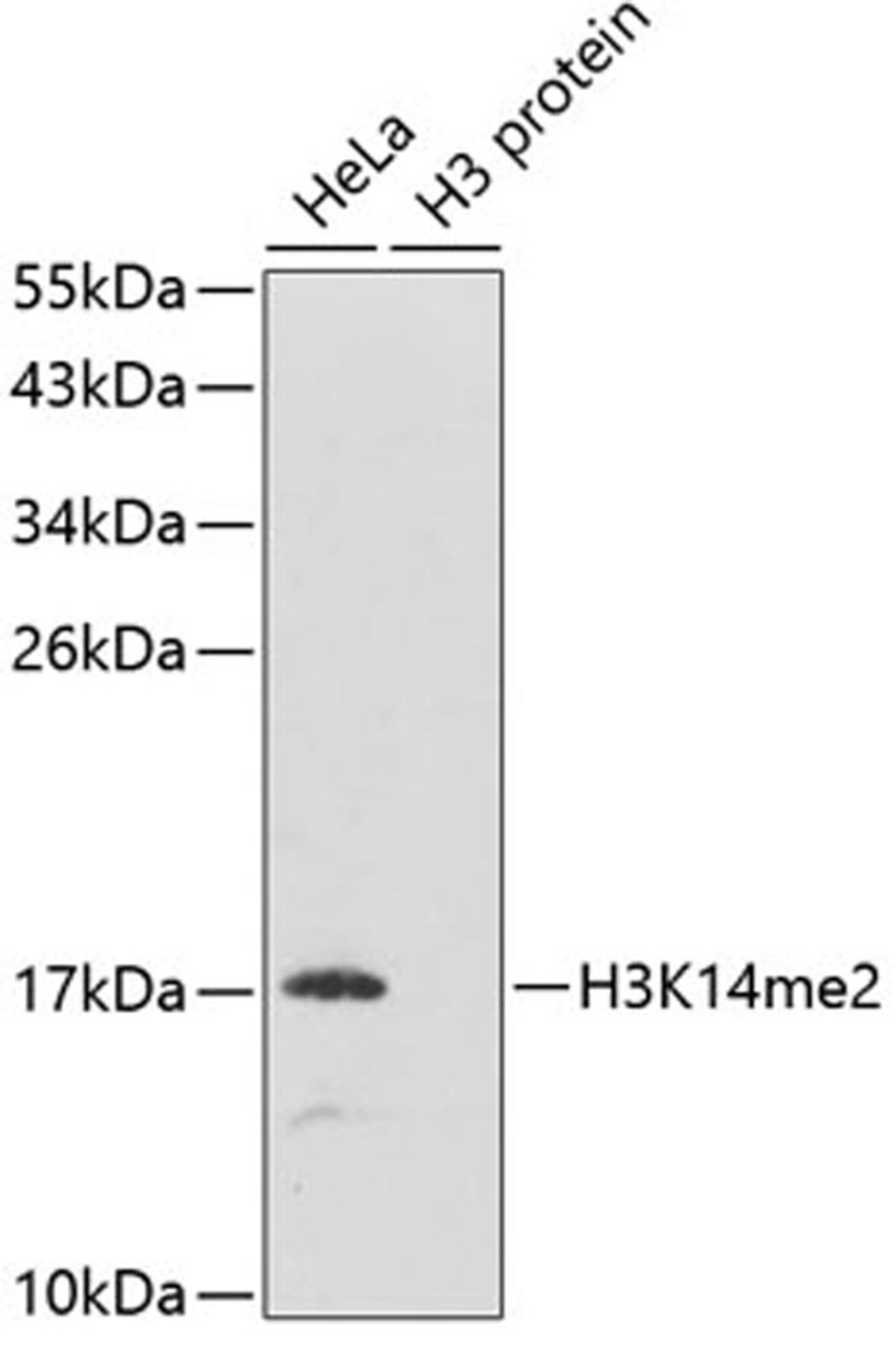 Western blot - DiMethyl-Histone H3-K14 antibody (A5278)