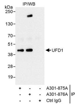 Detection of human UFD1 by western blot of immunoprecipitates.