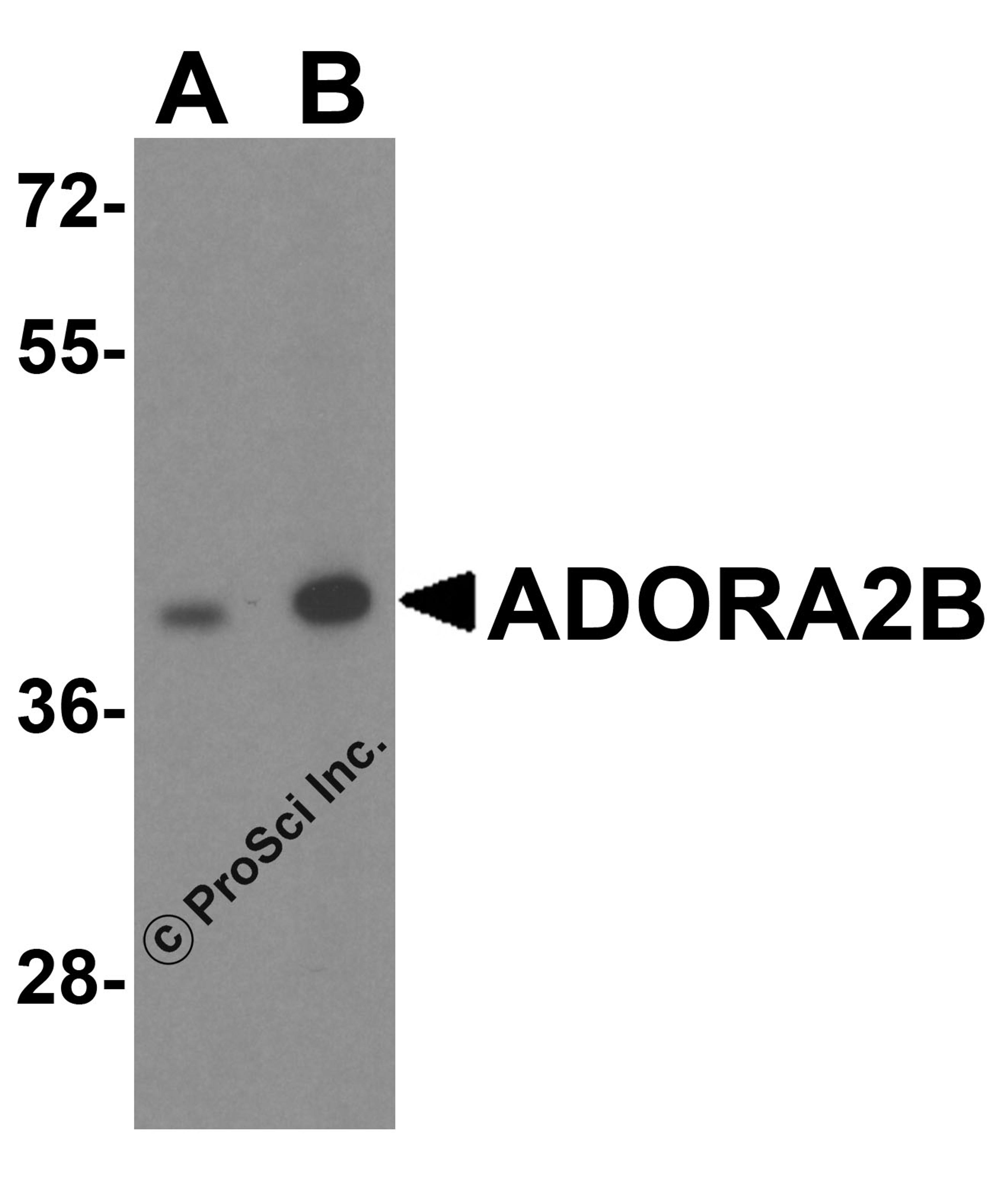 Western blot analysis of ADORA2B in mouse kidney tissue lysate with ADORA2B antibody at (A) 0.25 and (B) 0.5 μg/mL
