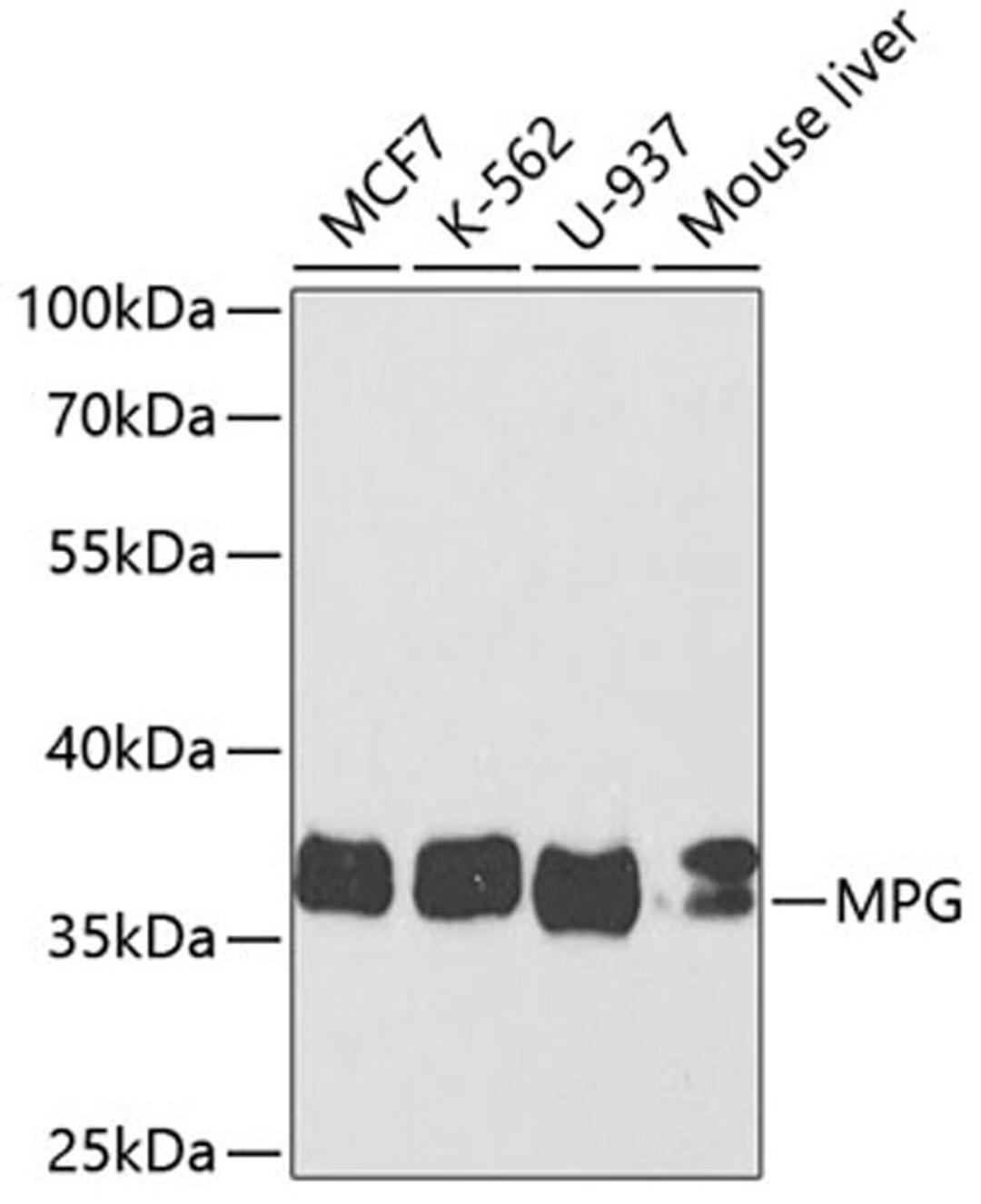 Western blot - MPG antibody (A5410)