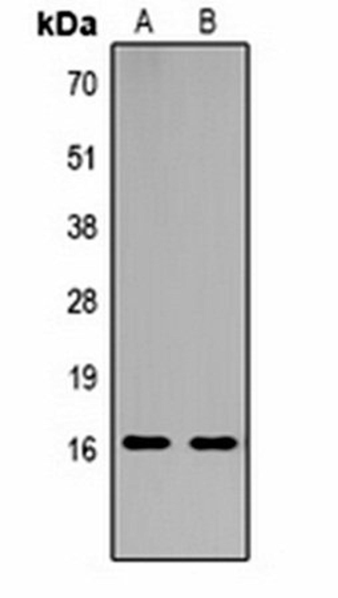 Western blot analysis of  Hela (Lane1), NIH3T3 (Lane2) whole cell lysates using Histone H3 (TriMethyl K18) antibody