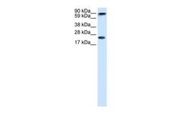 Antibody used in WB on Human brain at 1.25 ug/ml.