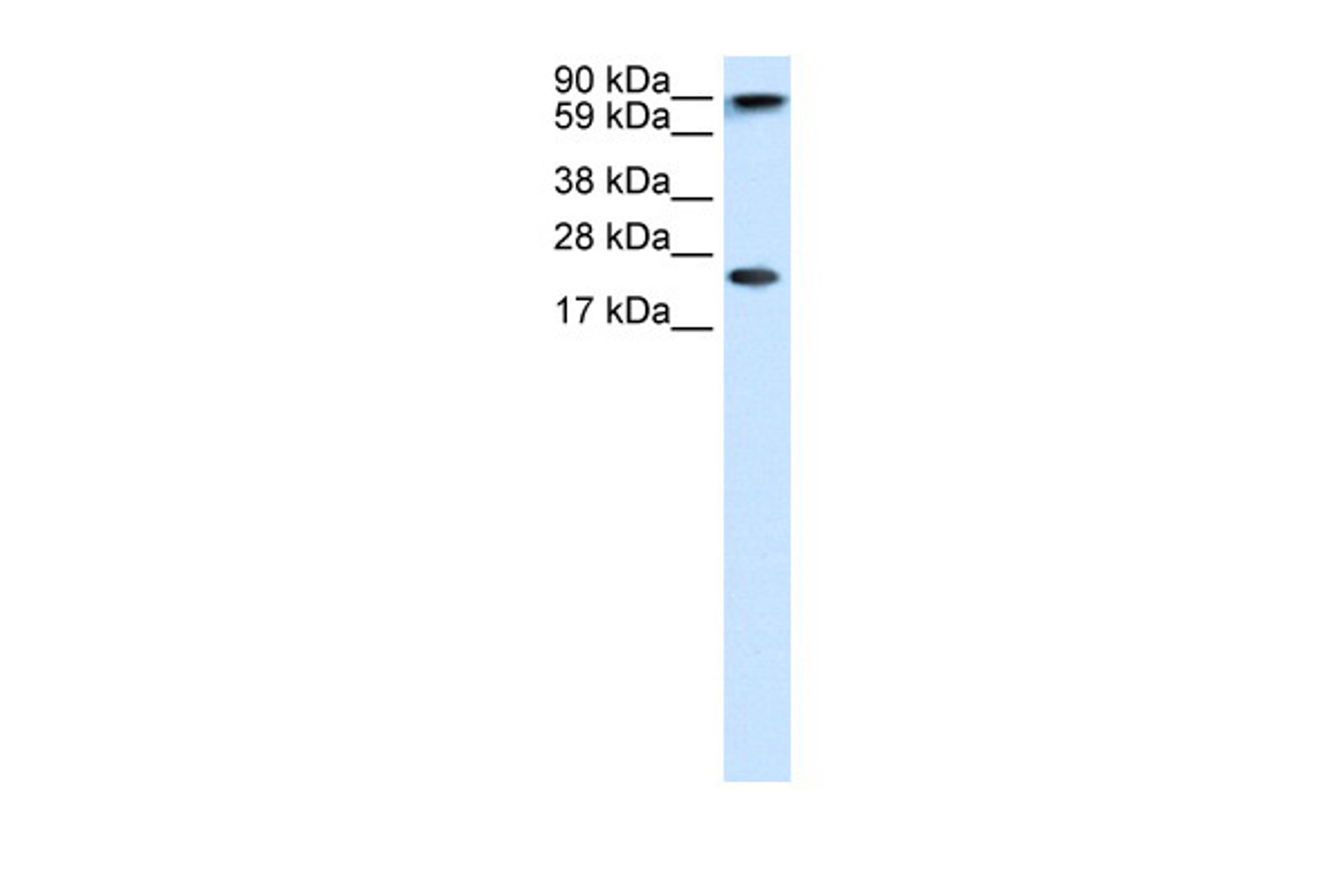 Antibody used in WB on Human brain at 1.25 ug/ml.