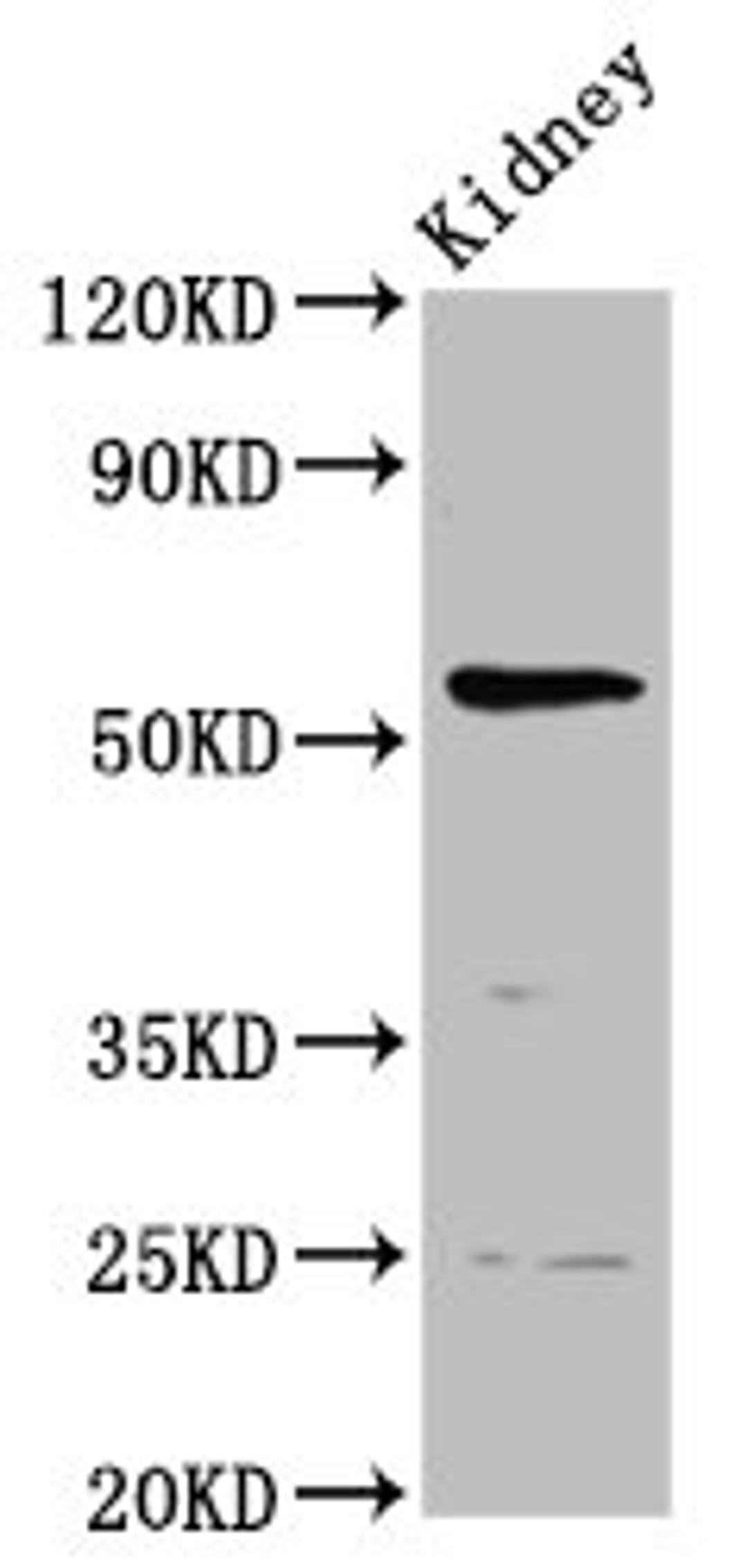 Western Blot. Positive WB detected in: Rat kidney tissue. All lanes: PIGW antibody at 3.7ug/ml. Secondary. Goat polyclonal to rabbit IgG at 1/50000 dilution. Predicted band size: 57 kDa. Observed band size: 57 kDa. 