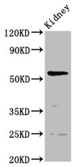 Western Blot. Positive WB detected in: Rat kidney tissue. All lanes: PIGW antibody at 3.7ug/ml. Secondary. Goat polyclonal to rabbit IgG at 1/50000 dilution. Predicted band size: 57 kDa. Observed band size: 57 kDa. 