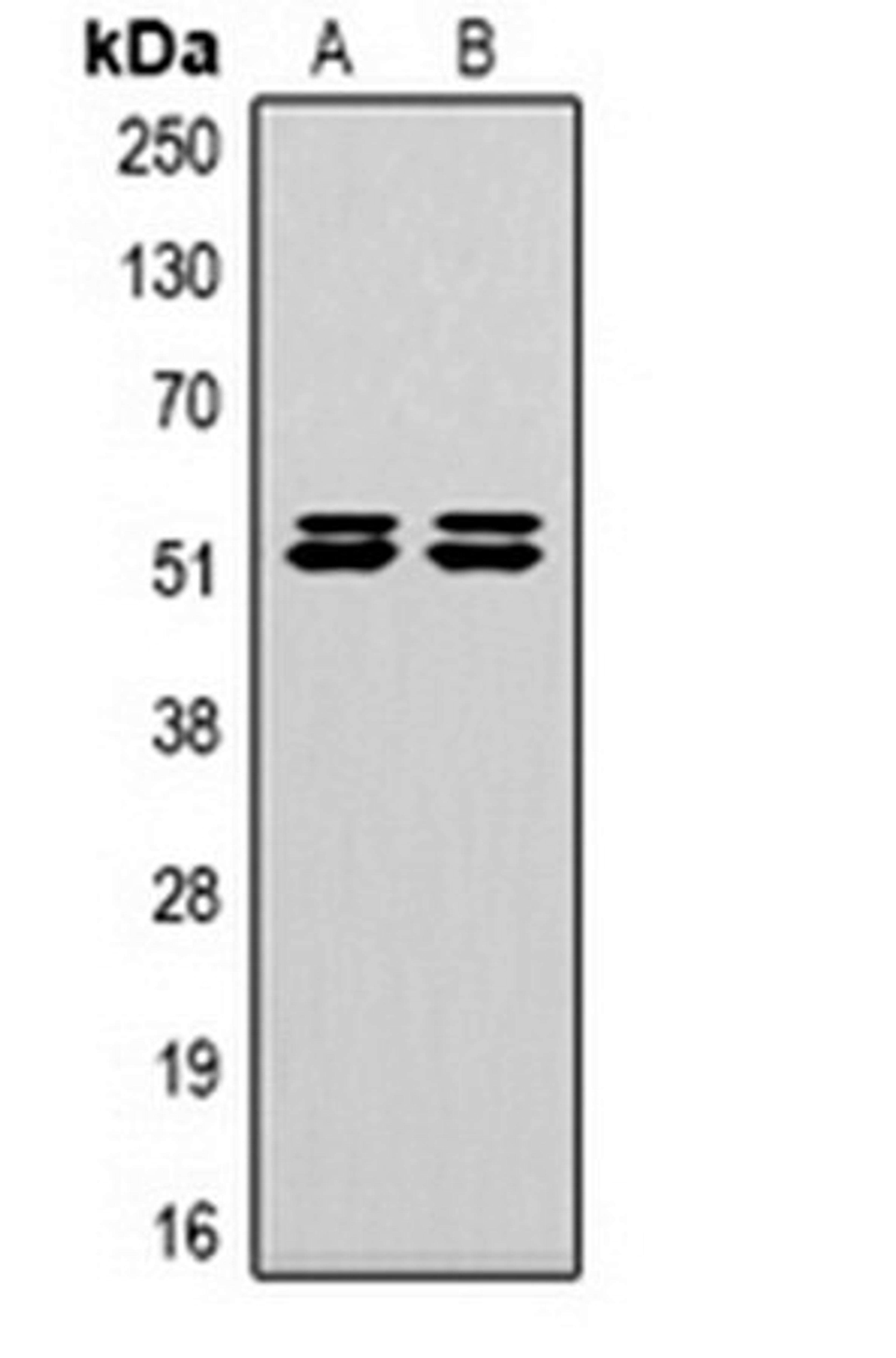 Western blot analysis of Hela (Lane 1), 293T (Lane 2) whole cell lysates using Carbonic Anhydrase 9 antibody