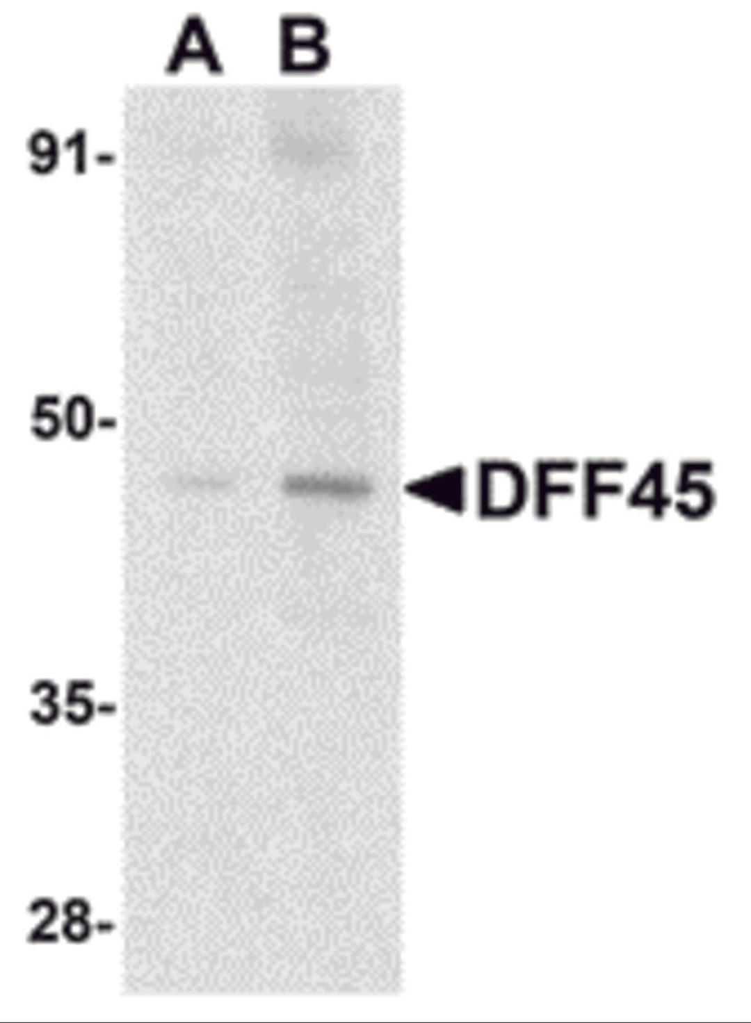 Western blot analysis of DFF45 in HeLa cell lysate with DFF45 antibody at (A) 1 and (B) 2 &#956;g/mL.