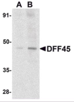 Western blot analysis of DFF45 in HeLa cell lysate with DFF45 antibody at (A) 1 and (B) 2 &#956;g/mL.