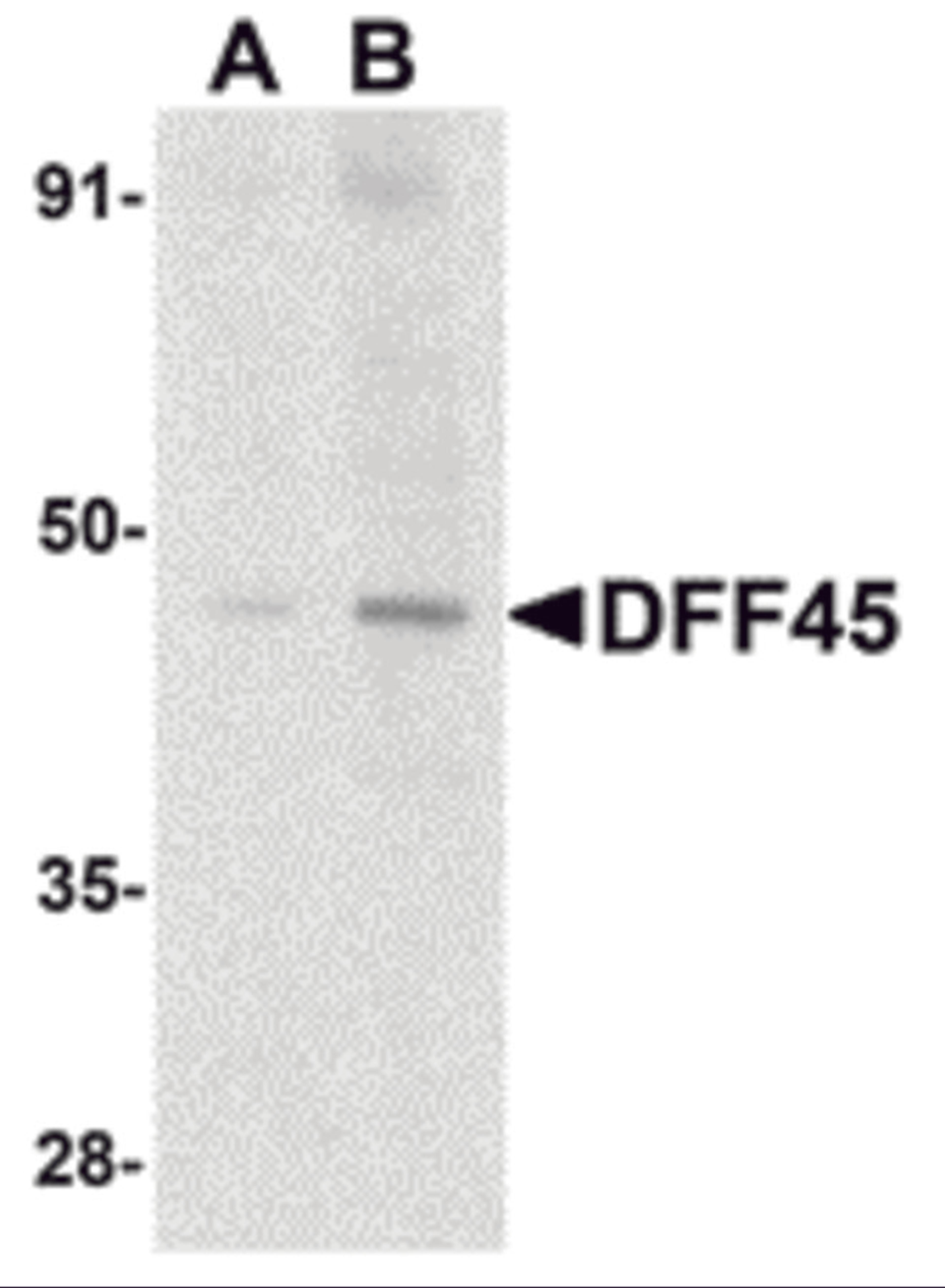 Western blot analysis of DFF45 in HeLa cell lysate with DFF45 antibody at (A) 1 and (B) 2 μg/mL.