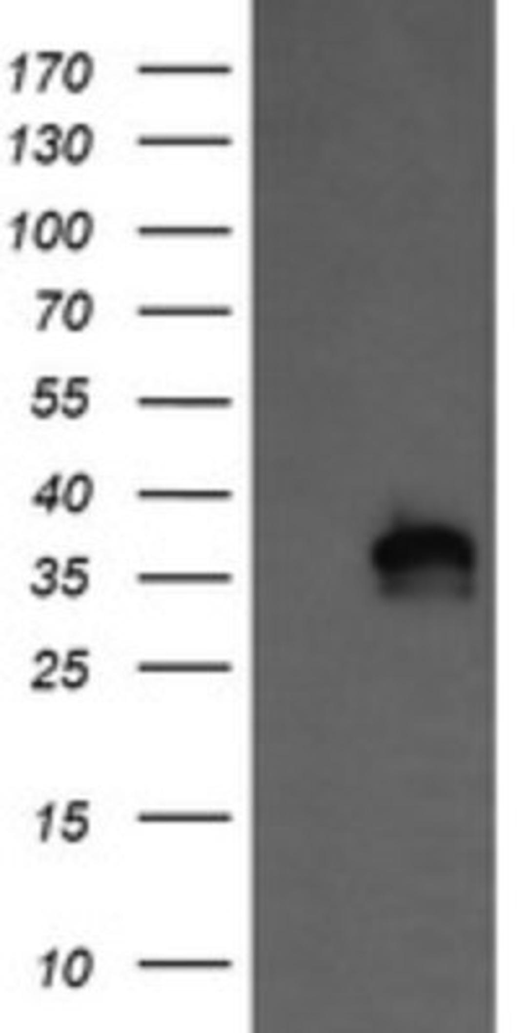 Western Blot: KIF25 Antibody (2F4) [NBP2-45768] - Analysis of HEK293T cells were transfected with the pCMV6-ENTRY control (Left lane) or pCMV6-ENTRY KIF25 .