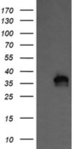 Western Blot: KIF25 Antibody (2F4) [NBP2-45768] - Analysis of HEK293T cells were transfected with the pCMV6-ENTRY control (Left lane) or pCMV6-ENTRY KIF25 .