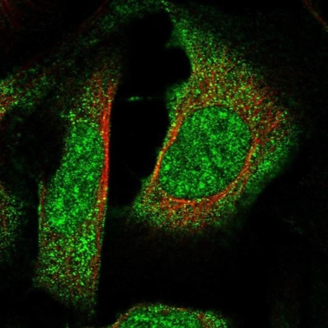 Immunocytochemistry/Immunofluorescence: RBM42 Antibody [NBP1-82770] - Staining of human cell line U-2 OS shows positivity in nucleus & cytoplasm.