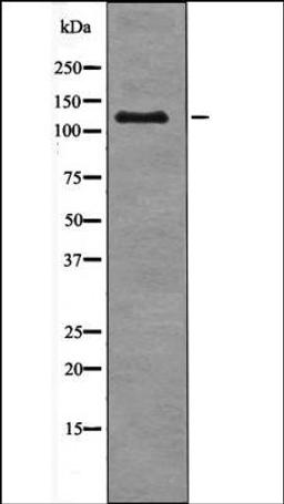 Western blot analysis of SW626 whole cell lysates using JAK3 -Phospho-Tyr904- antibody