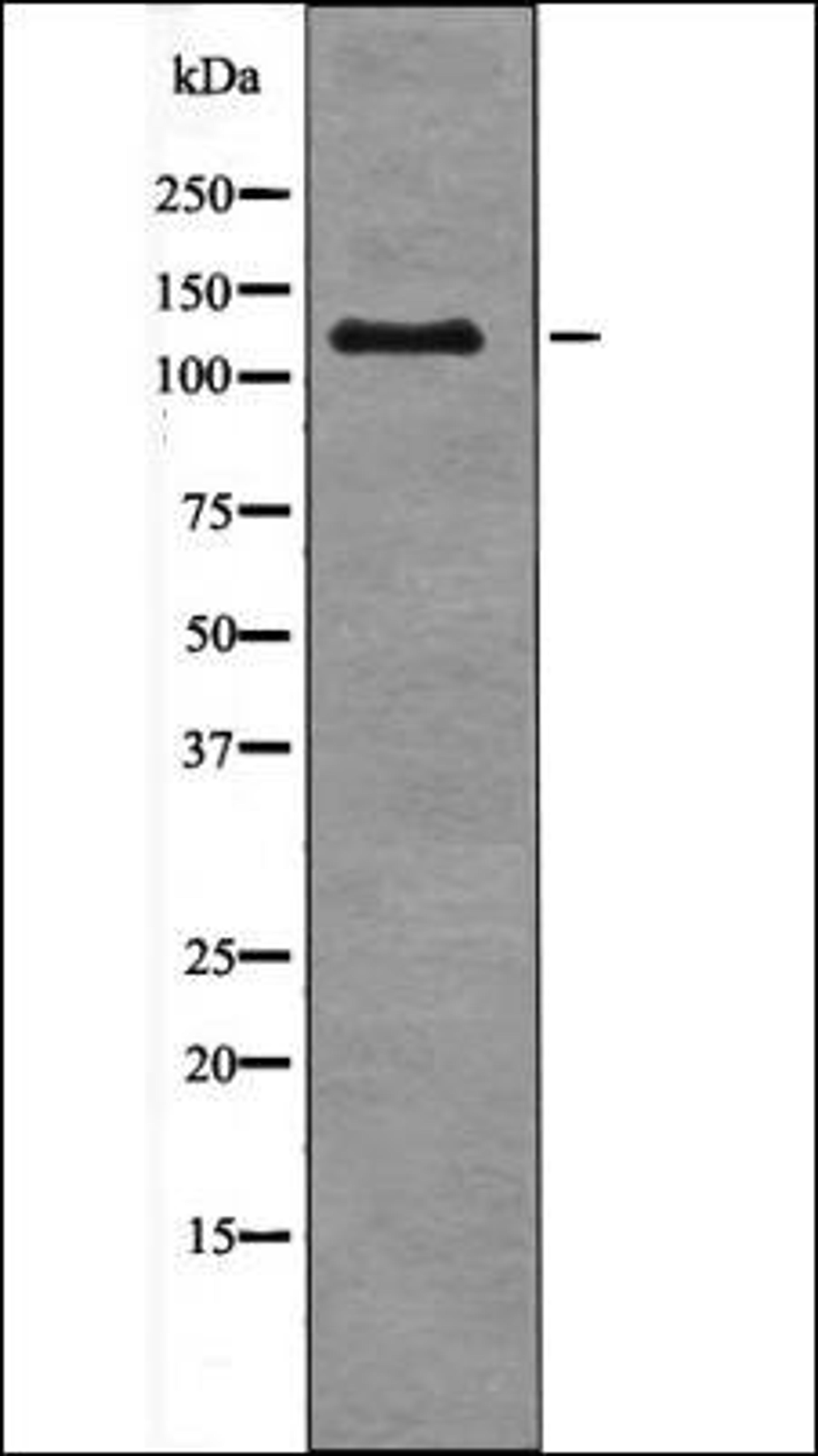 Western blot analysis of SW626 whole cell lysates using JAK3 -Phospho-Tyr904- antibody