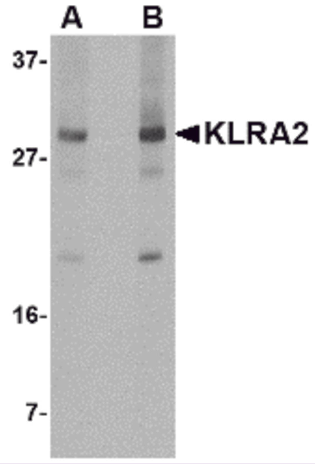 Western blot analysis of KLRA2 in mouse spleen tissue lysate with KLRA2 antibody at (A) 0.5 and (B) 1 μg/mL.