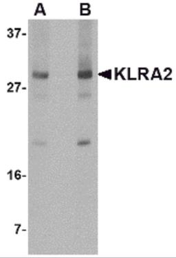 Western blot analysis of KLRA2 in mouse spleen tissue lysate with KLRA2 antibody at (A) 0.5 and (B) 1 μg/mL.