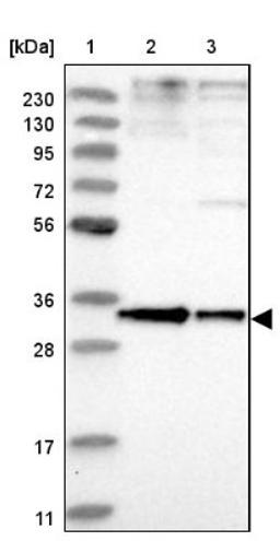 Western Blot: Phosphopantothenate-cysteine ligase Antibody [NBP1-87398] - Lane 1: Marker [kDa] 230, 130, 95, 72, 56, 36, 28, 17, 11<br/>Lane 2: Human cell line RT-4<br/>Lane 3: Human cell line U-251MG sp