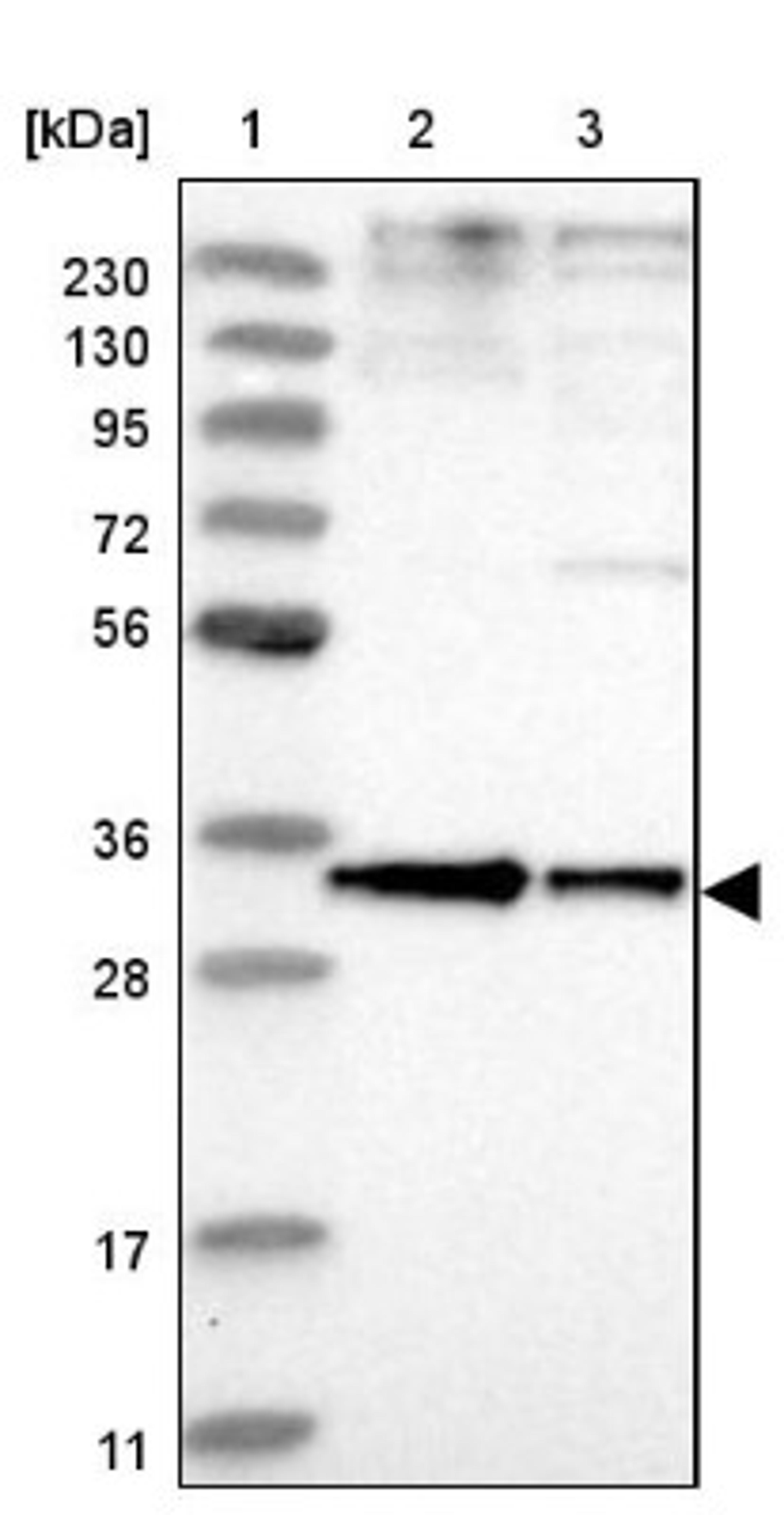 Western Blot: Phosphopantothenate-cysteine ligase Antibody [NBP1-87398] - Lane 1: Marker [kDa] 230, 130, 95, 72, 56, 36, 28, 17, 11<br/>Lane 2: Human cell line RT-4<br/>Lane 3: Human cell line U-251MG sp