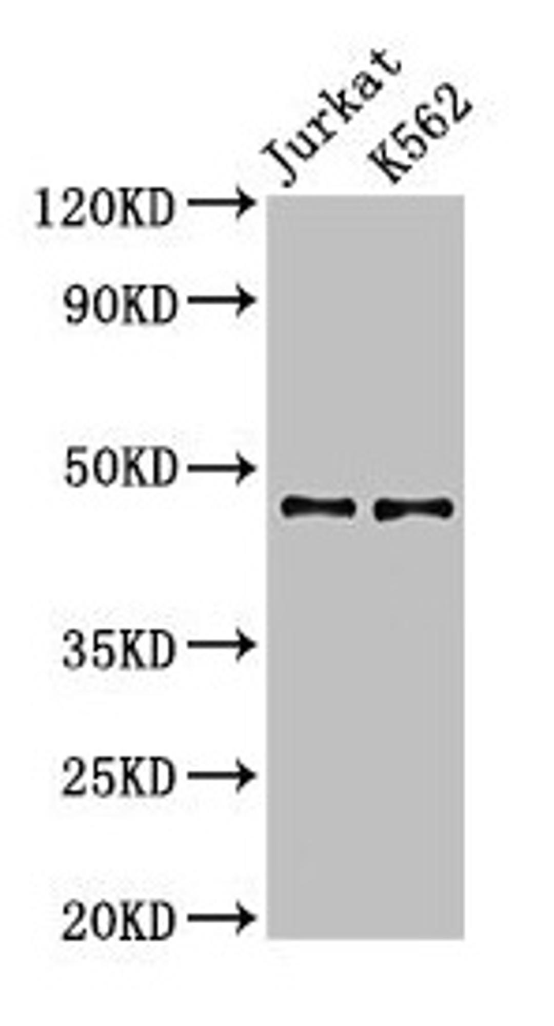 Western Blot. Positive WB detected in: Jurkat whole cell lysate, K562 whole cell lysate. All lanes: LDB1 antibody at 3.2µg/ml. Secondary. Goat polyclonal to rabbit IgG at 1/50000 dilution. Predicted band size: 47, 37, 43 kDa. Observed band size: 47 kDa
