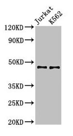 Western Blot. Positive WB detected in: Jurkat whole cell lysate, K562 whole cell lysate. All lanes: LDB1 antibody at 3.2µg/ml. Secondary. Goat polyclonal to rabbit IgG at 1/50000 dilution. Predicted band size: 47, 37, 43 kDa. Observed band size: 47 kDa