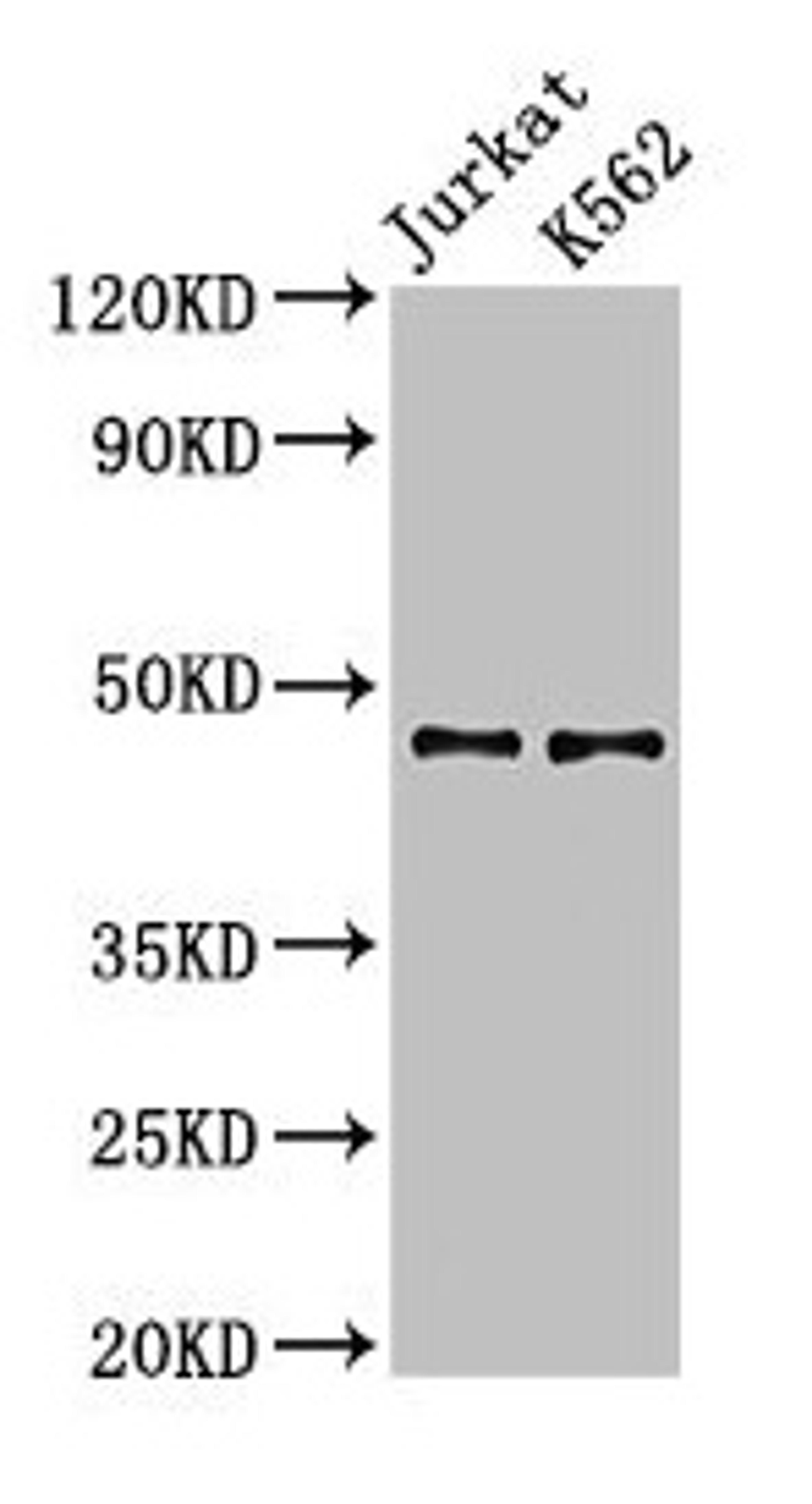 Western Blot. Positive WB detected in: Jurkat whole cell lysate, K562 whole cell lysate. All lanes: LDB1 antibody at 3.2µg/ml. Secondary. Goat polyclonal to rabbit IgG at 1/50000 dilution. Predicted band size: 47, 37, 43 kDa. Observed band size: 47 kDa