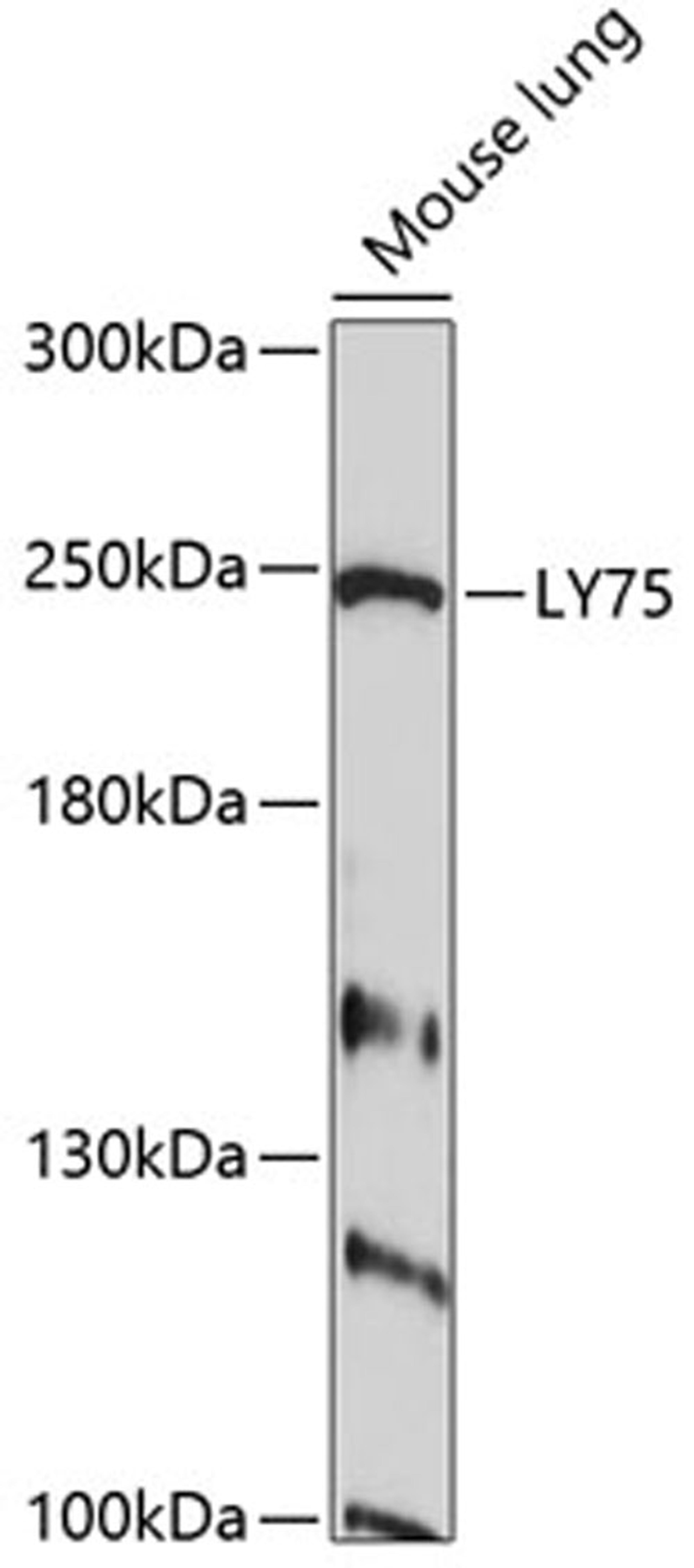 Western blot - LY75 antibody (A10065)