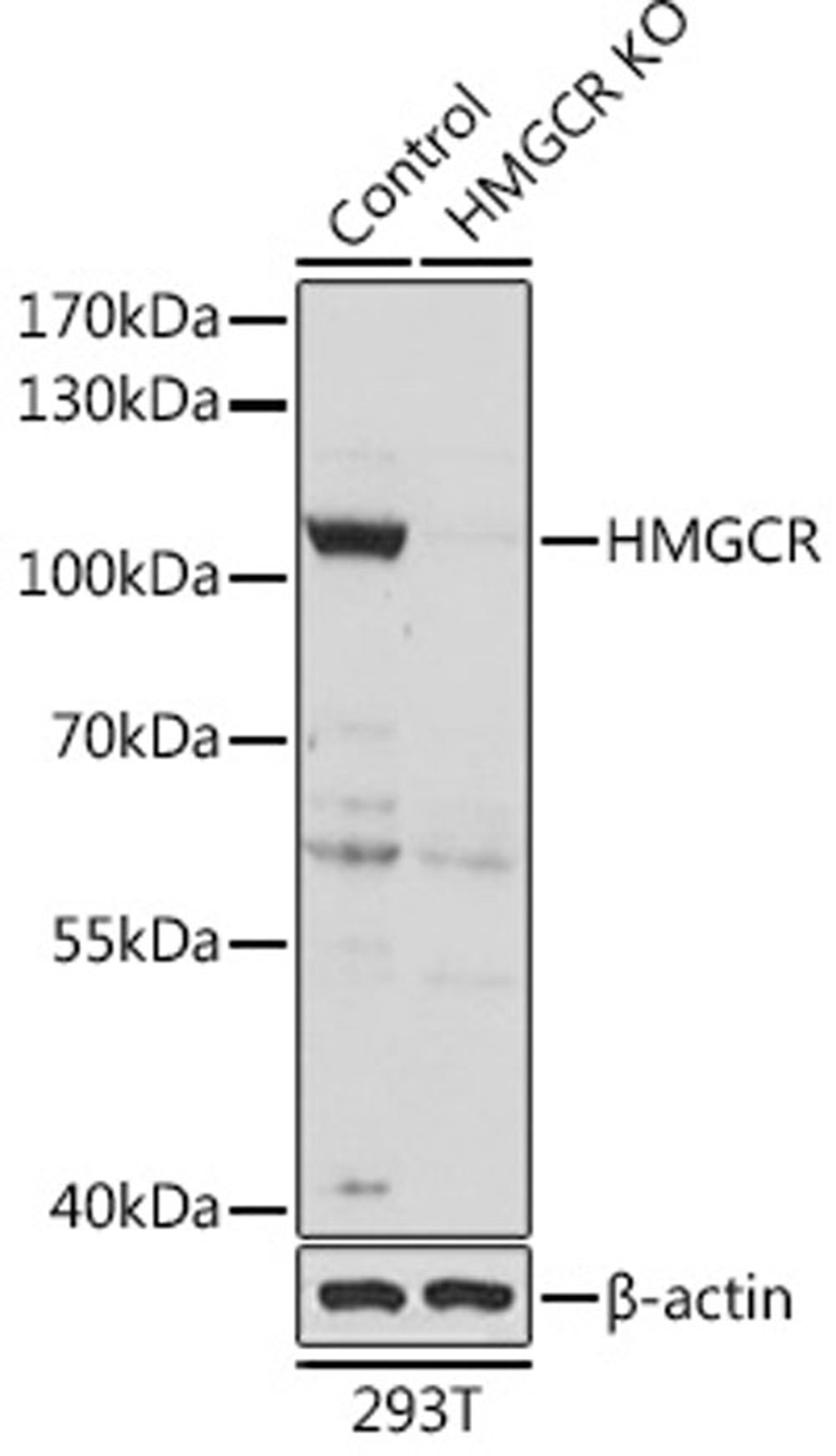 Western blot - HMGCR antibody (A16876)