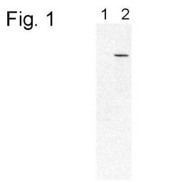 Western Blot: PDE6 beta Antibody [NB120-5663] - Analysis of PDE6 beta. Lane 1 demostrates no detection on extracts of RD mice. Lane 2 shows a single band at ~90 kDa on Balb/C extracts.